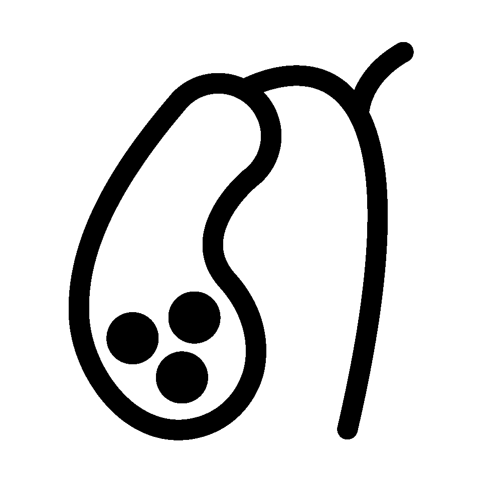 Gallstone